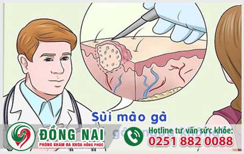 Sùi Mào Có Ngứa Không? Cách Chữa Hiệu Quả Nhanh Hết